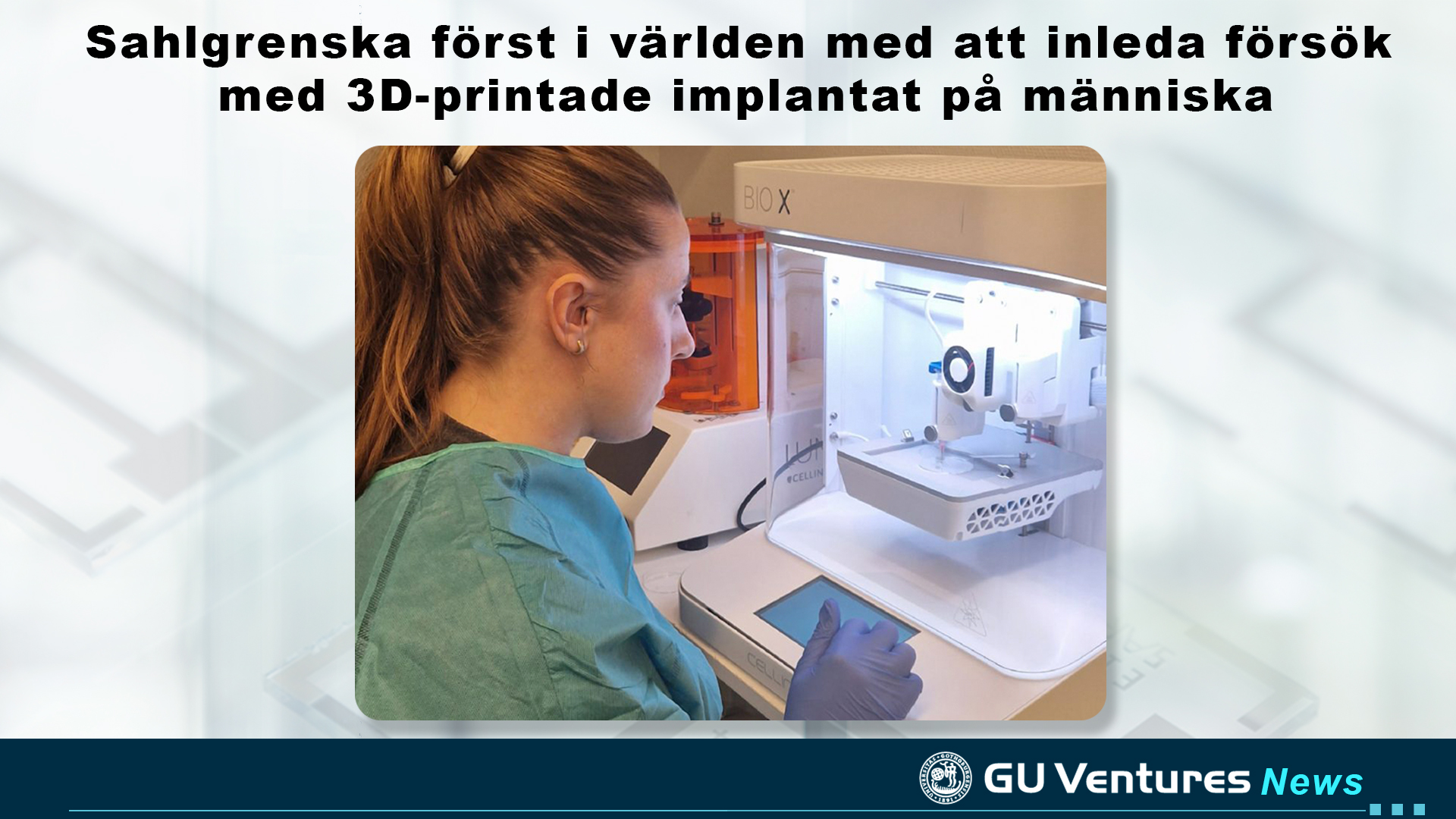 Sahlgrenska inleder försök med 3D-printade implantat på människa
